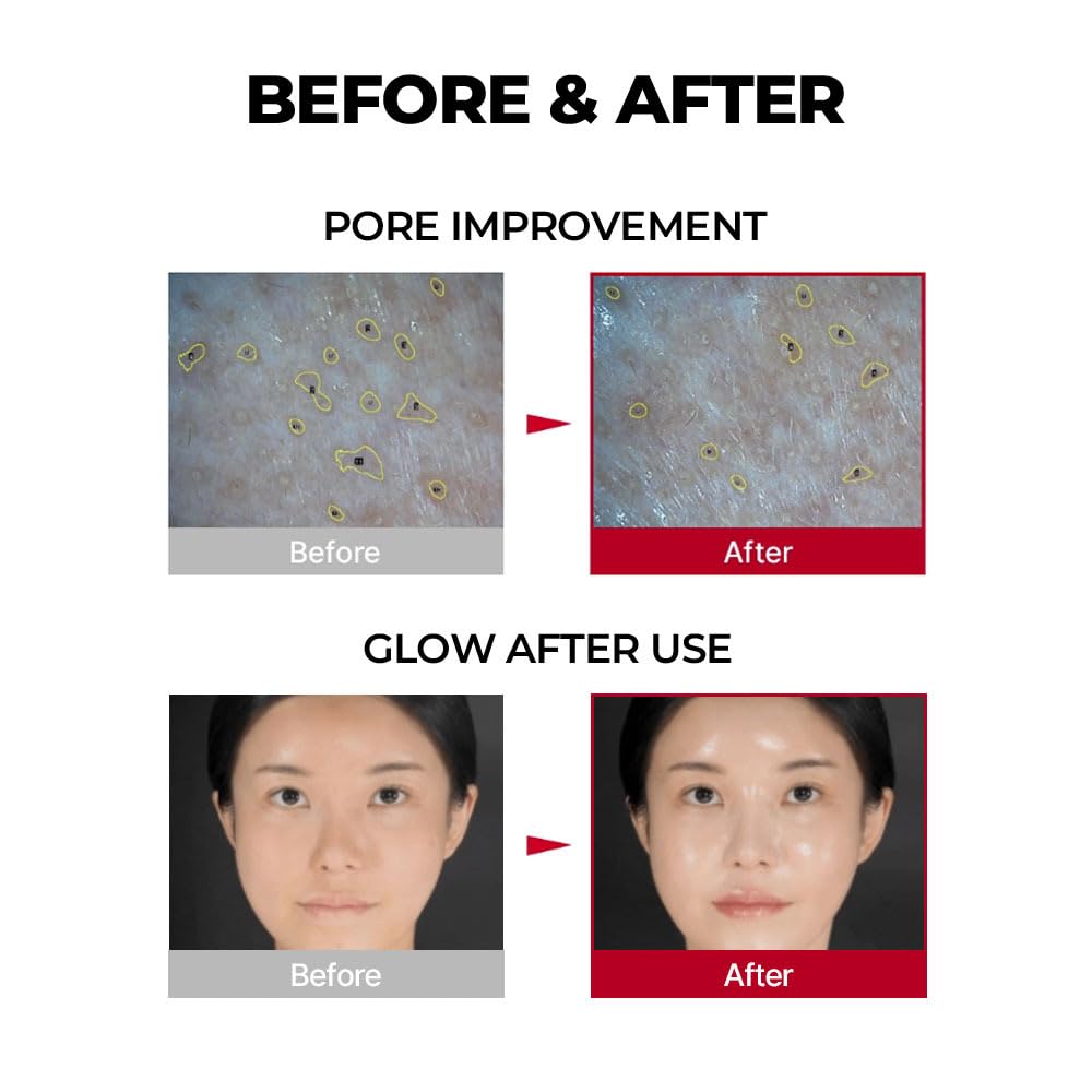 Medi Peel - Red Lacto Collagen Wrapping Mask - 70ml